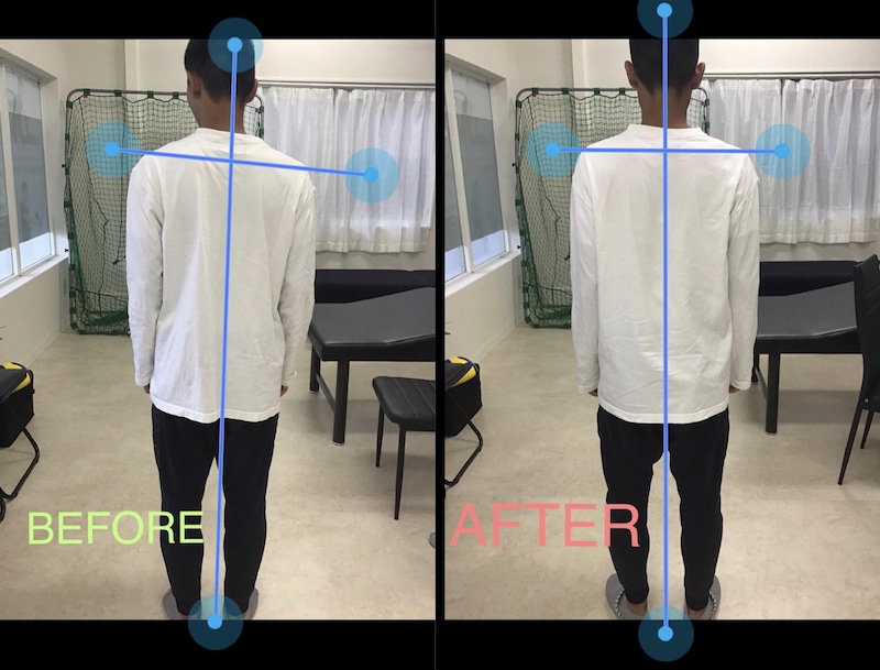 身体の歪みから、走ると痛い症状が改善 イメージ03